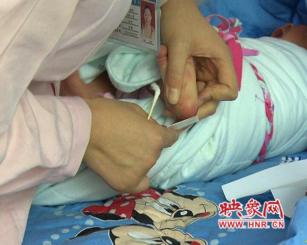醫(yī)護(hù)人員在為一名新出生嬰兒采足跟血，做疾病篩查