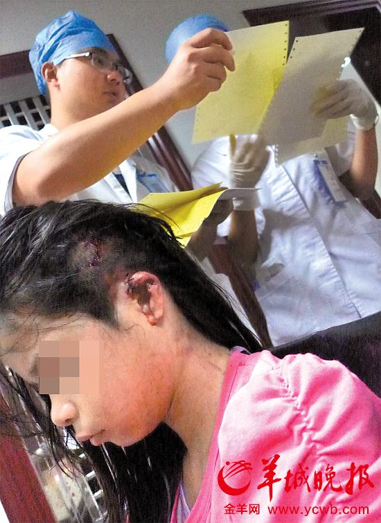 受傷的11歲女孩頭發(fā)被卷入扶梯，耳朵被嚴(yán)重拉傷，需手術(shù)。