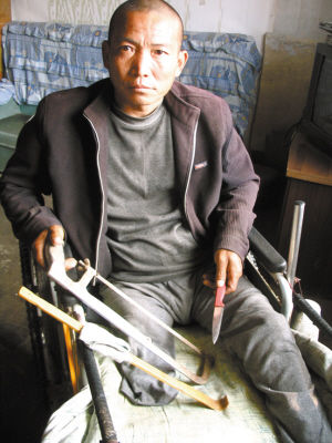 鄭艷良就是用這幾樣簡陋工具，給自己做了右腿截肢手術(shù)。