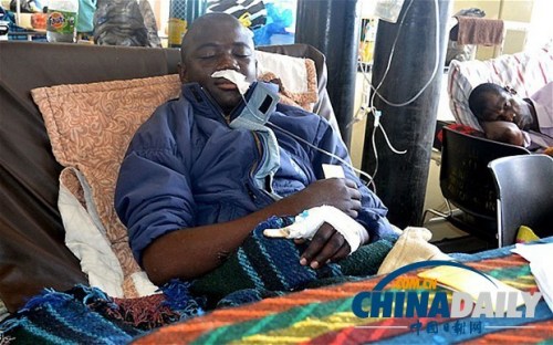 雖然已經(jīng)在醫(yī)院接受了近一個(gè)月的恢復(fù)治療，卡托卡的身體仍然非常虛弱。