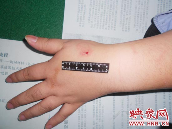 為幫助無(wú)證駕駛的朋友逃避處罰，新鄉(xiāng)的王某竟對(duì)執(zhí)勤民警大打出手，還將一名民警的手臂咬傷