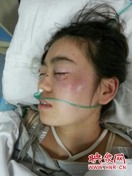 9月10日晚,被暴打的小陳出現(xiàn)了間歇性昏迷,被送進(jìn)了省人民醫(yī)院。