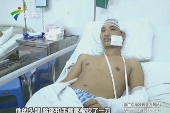 另一名傷者頭部、臉部和手臂都被砍了一刀。(視頻截圖)