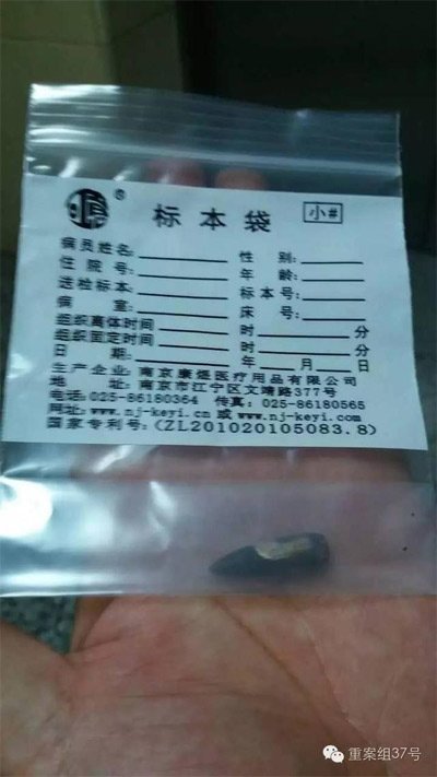 經(jīng)警方鑒定，秦女士體內(nèi)取出的子彈系56式步槍射出 。 受訪者供圖
