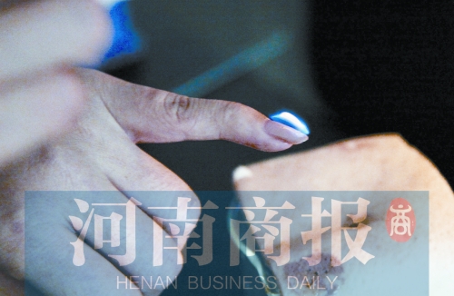 將指甲油涂在指甲上，靠近火焰時(shí)被引燃了